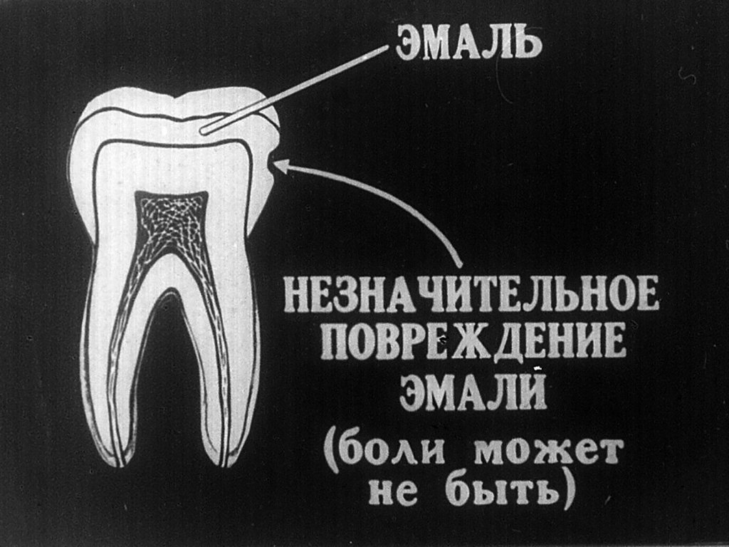 Берегите зубы
